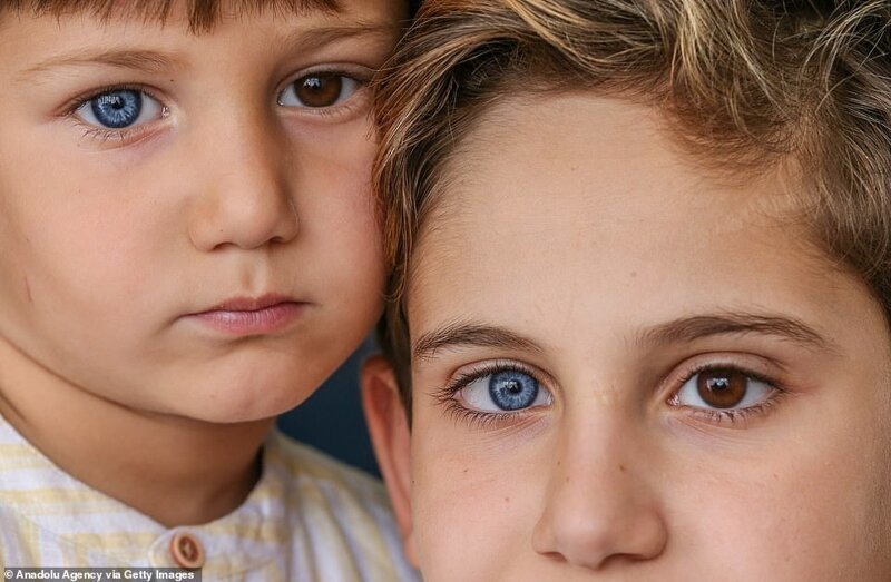 Разноцветные гены: братья из Турции с редкой гетерохромией завораживают с первого взгляда (8 фото)