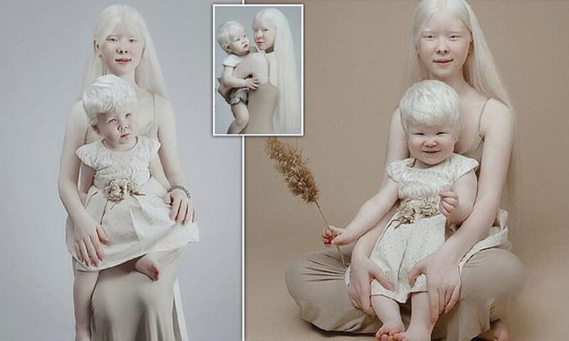 Сестры-альбиносы завоевывают модельный мир Казахстана (12 фото)