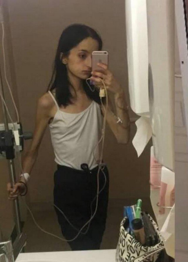 Инес де Мура из Франции победила анорексию и научилась ценить жизнь (16 фото)