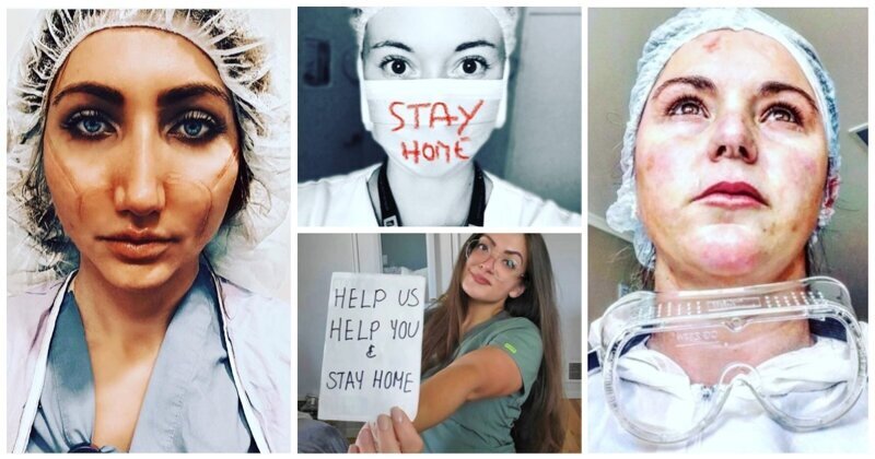Пронзительные фото ран на лицах красавиц-медсестер, которые просят вас оставаться дома (21 фото)