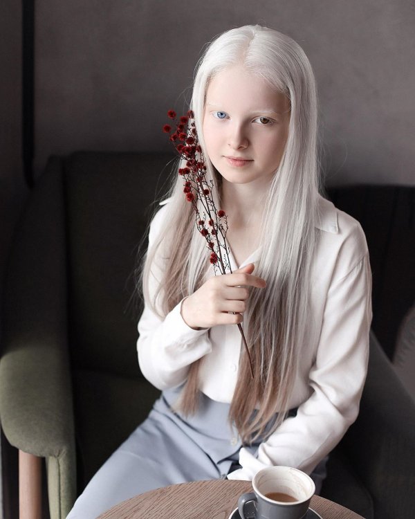 Амина Эпендиева - 11 летняя девочка из Чечни, которая поразила соцсети своей внешностью (7 фото)