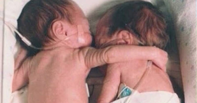 Медсестра кладёт здорового ребёнка рядом с умирающим близнецом и тут происходит настоящее чудо! (3 фото + 1 видео)