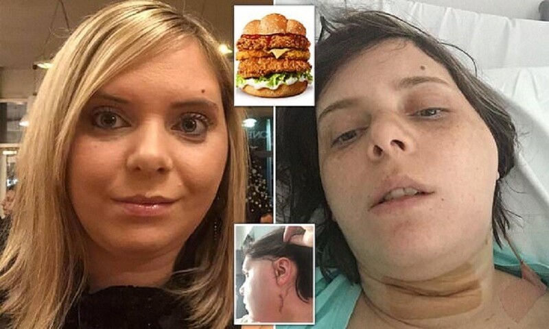 Женщина сломала челюсть бургером (8 фото)