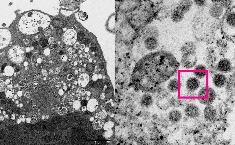 Ученые опубликовали фотографии вируса «Омикрон» (3 фото)